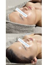 クレヴィー(Creviy)/最先端の最強細胞美容コース