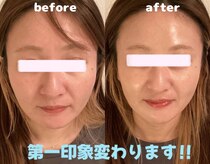 ミニョン(mignon)