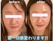 ミニョン(mignon)の写真