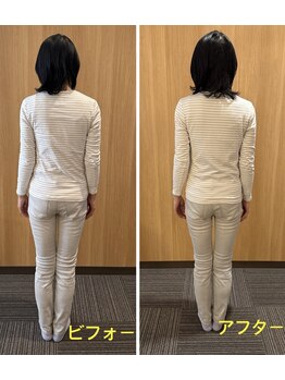 ルクシア(Luxia)/お写真で初めて歪みを確認