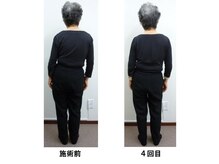 整体処たまゆら/体の歪み・傾きビフォーアフター