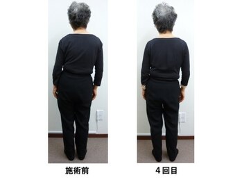 整体処たまゆら/体の歪み・傾きビフォーアフター