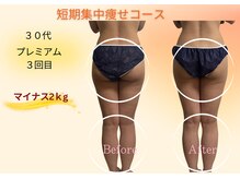 ヨサパーク リボーン(YOSA PARK Reborn)/劇的ビフォーアフター/痩身駒込