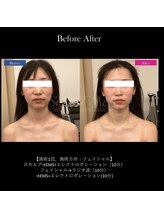 グラシアス/グラシアス | 症例写真