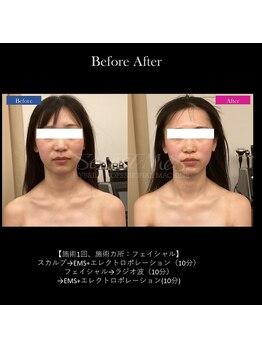 グラシアス/グラシアス | 症例写真