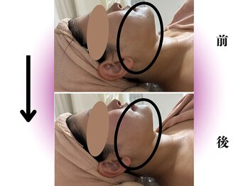 カリアンヌ/ローズ蒸しテント&フェイシャル