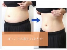 ヨサパーク スピカ 我孫子(YOSA PARK spicA)の雰囲気(結果重視◎ぽっこりお腹、下半身痩せ、二の腕、お任せください♪)