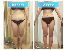 ドクタービセア 池袋店(DR.VISEA)/充実痩身で健康的に変われる