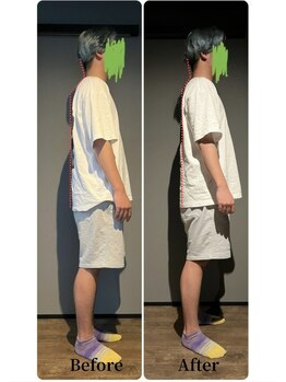 ニュートラル(NEUTRAL)/整体ビフォーアフター