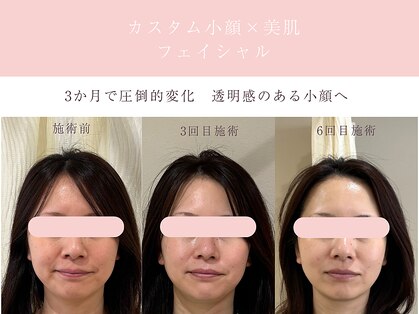 シンナリ(Shinnari)の写真