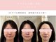 シンナリ(Shinnari)の写真