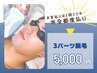 【メンズ都度払い☆プチ脱毛】パーツ脱毛３ヶ所 ¥5,000