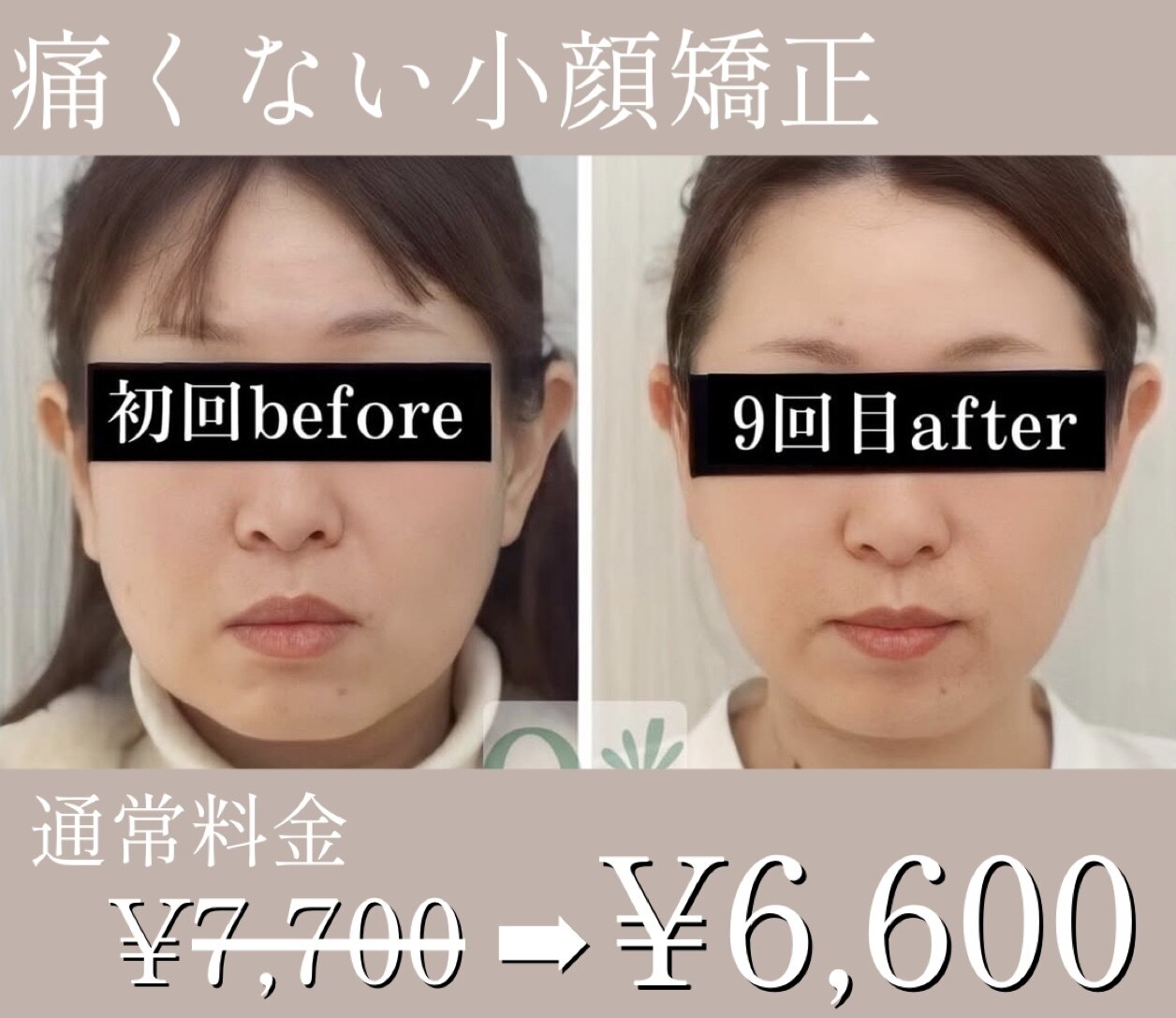 VFアジャスター‼️整体✨美容✨マッサージ✨小顔矯正✨頭蓋矯正 orlytec methods | 小顔美容矯正サロン -頭蓋骨を優しくアジャスト