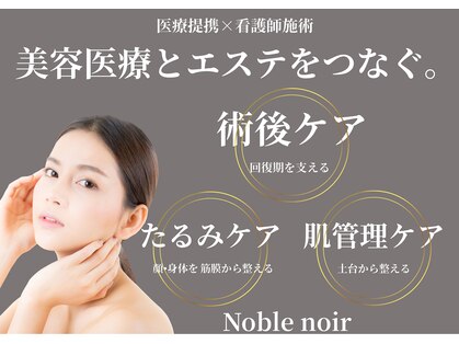 ノーブルノアール(Noble noir)の写真