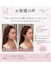 小顔美肌ファクトリー 梅田院/お客様の声
