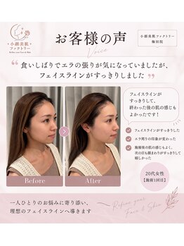 小顔美肌ファクトリー 梅田院/お客様の声