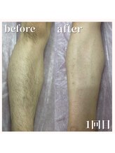 おうちサロン しゅろ/ムダ毛無しのオシャレな男性に☆