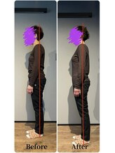 ニュートラル(NEUTRAL)/整体ビフォーアフター