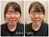 ■人気No.2■脱！老け顔・不機嫌顔☆最強小顔フェイシャル