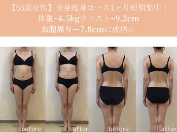 エターナルフレーム(Eternal Flame)/53歳痩身スリムビフォーアフター