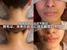 グラスト(Grast)
