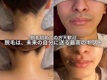 グラスト(Grast)の写真