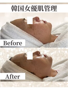 ドレス(dress)/肌悩み解消！