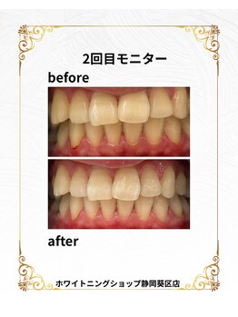 ホワイトニングショップ 葵区静岡駅店/ホワイトニング店ホワイトニング