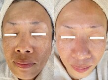 サラシック(salachic)の雰囲気（４０代以降の複雑なシミケア！シワ、こじわが気になる）