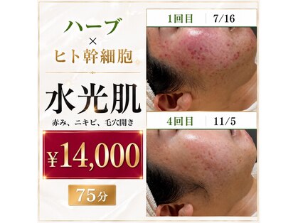 リンフェイス 高松店(LINFACE)の写真