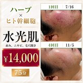 リンフェイス 高松店(LINFACE)