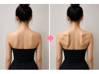こう整骨院の写真/本気で痩せたい方限定！人気のダイエットメニューで美くびれGET！初回体験3000円！ぜひ一度お試し下さい☆