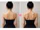 こう整骨院の写真/本気で痩せたい方限定！人気のダイエットメニューで美くびれGET！初回体験3000円！ぜひ一度お試し下さい☆