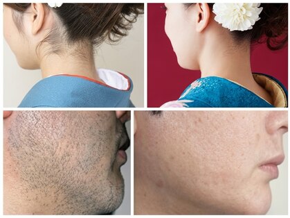 ベラドンナ(Bella Donna)の写真