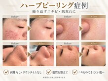 ベル 平塚(Belle)
