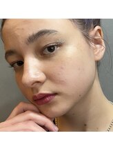 ライル(RILE)/ラッシュリフト