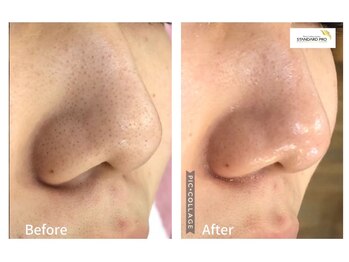 ビューティーサロンエイト(Beauty Salon8)/