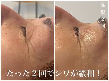 ダン(dan)/【陶肌トリートメント】症例