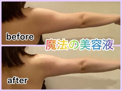 美肌痩身サロン ラエルヴェ(La Elever)の写真