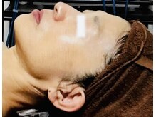 メディカルサロン かとれあ/お客様のお肌