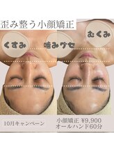 アンバー(amber)/効果抜群！小顔矯正★