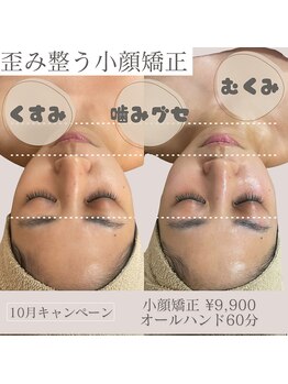 アンバー(amber)/効果抜群！小顔矯正★