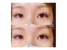 アネラ 仙台駅東口店(ANELA)/&Healthy