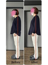 ニュートラル(NEUTRAL)/整体ビフォーアフター