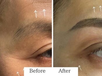 ミューズファクトリー(Muse factory)/目周りの小じわにもアプローチ！