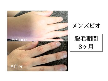 メンズビオ 神戸三宮店/