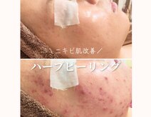 アナシアビューティーサロン(Anacia)
