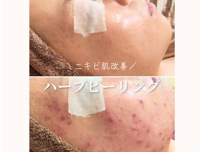 アナシアビューティーサロン(Anacia)の写真