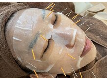 アスカル鍼灸整骨院の雰囲気（毛穴洗浄エステ×美容鍼）