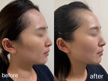 salon emma 【フェイシャルサロン&ネイルサロン】小顔/たるみ/韓国ネイル/1回の施術効果♪即効果実感◎